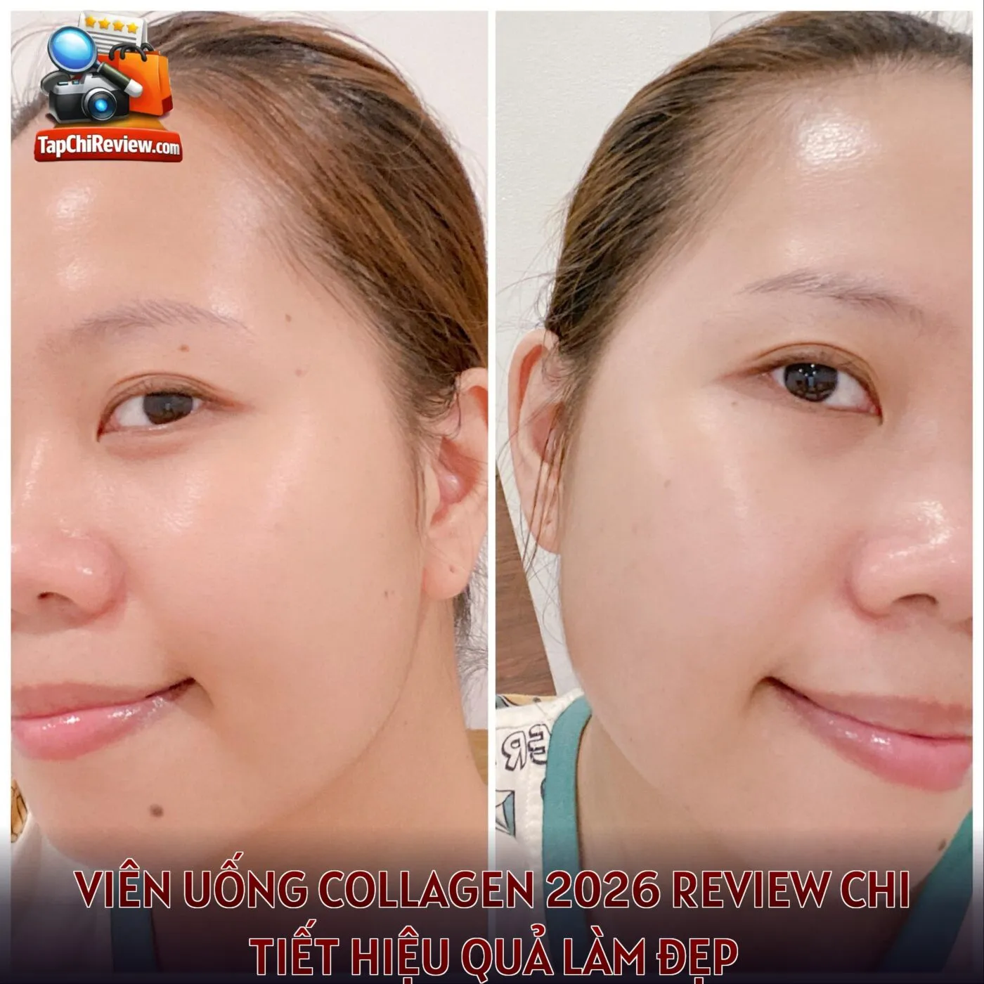 Viên uống collagen 2026 review chi tiết hiệu quả làm đẹp